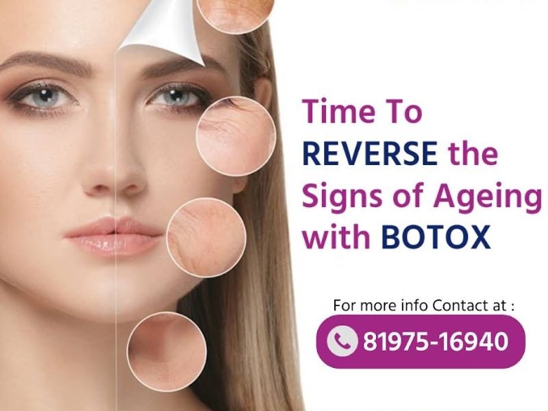 Botox treatment in Bangalore